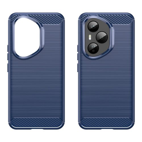 RMPACK Honor 400 Pro 5G Szilikon Tok Carbon Fiber Mintázattal Kék